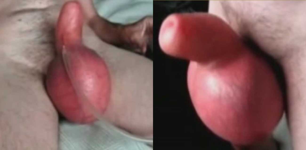 小鸡巴男生的福音  用充气机给鸡巴充气 鸡巴以肉眼可见的速度变大 效果令人满意