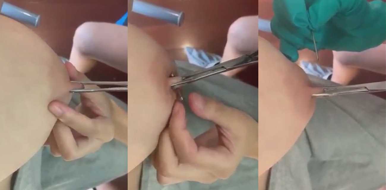 乳头穿孔特写视角 这看着就很疼 这以后还能给孩子喂奶吗？