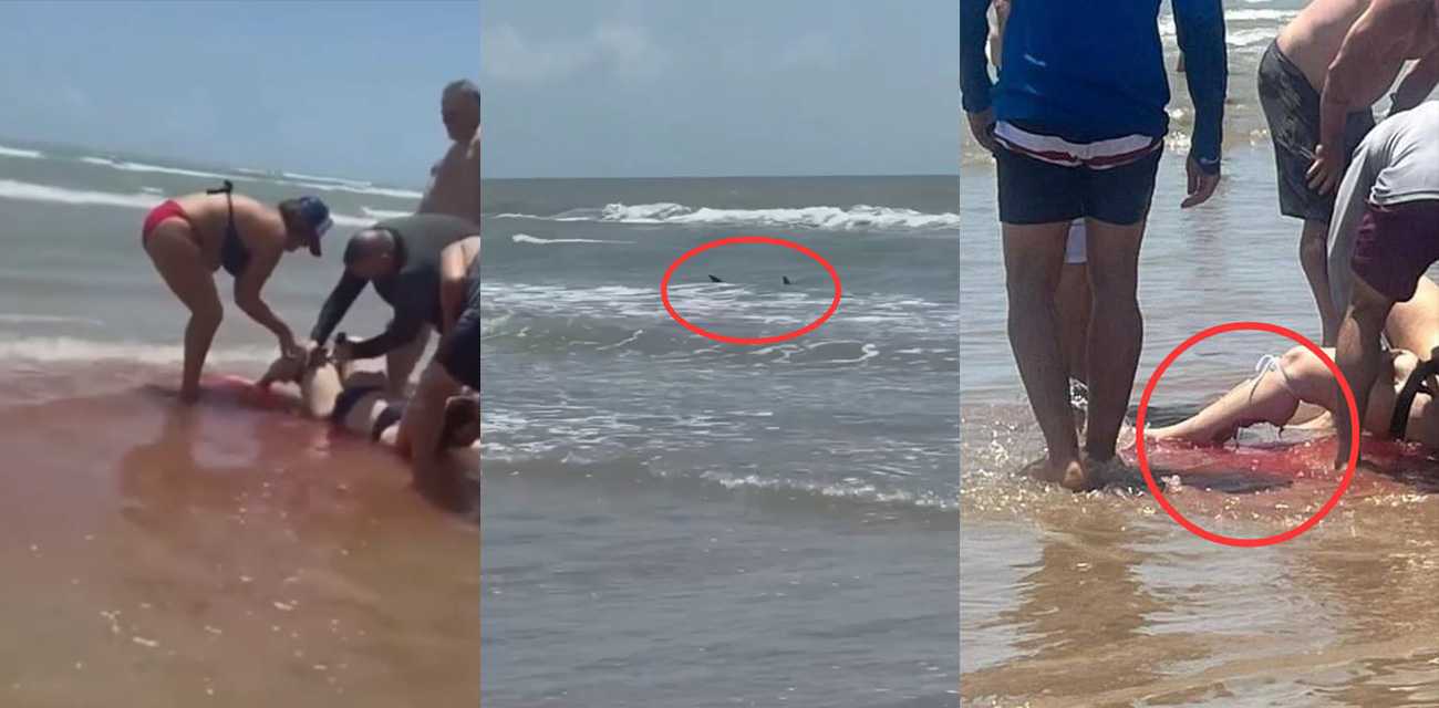 现实版大白鲨！美国德州南帕德里岛海滩发生大白鲨咬人事件 多人被咬伤 一名女子的半条腿被咬断！