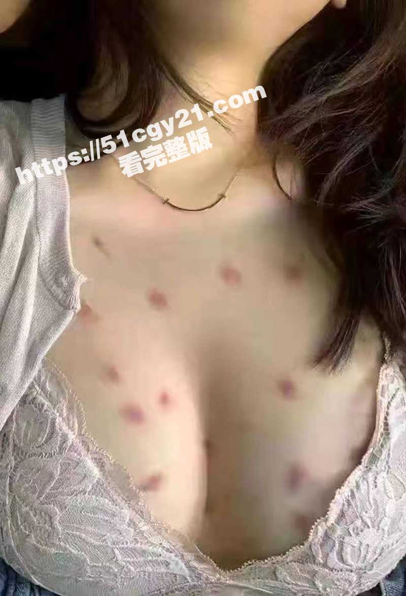 梅毒女性爱视频 (6)