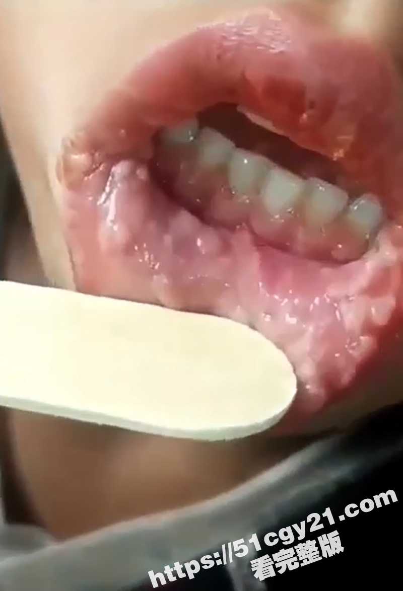 梅毒女性爱视频 (7)