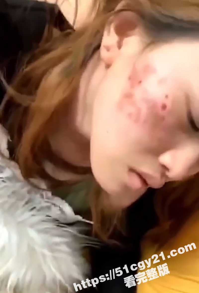 梅毒女性爱视频 (8)