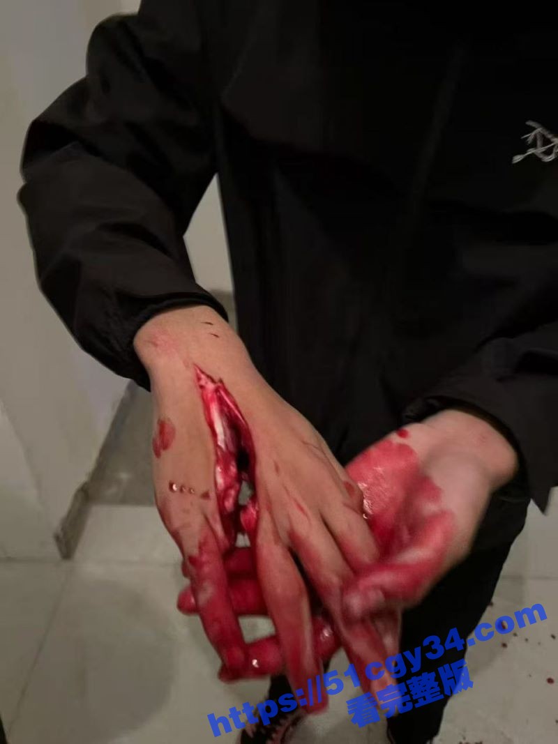 精神小伙台球厅持刀砍人 4