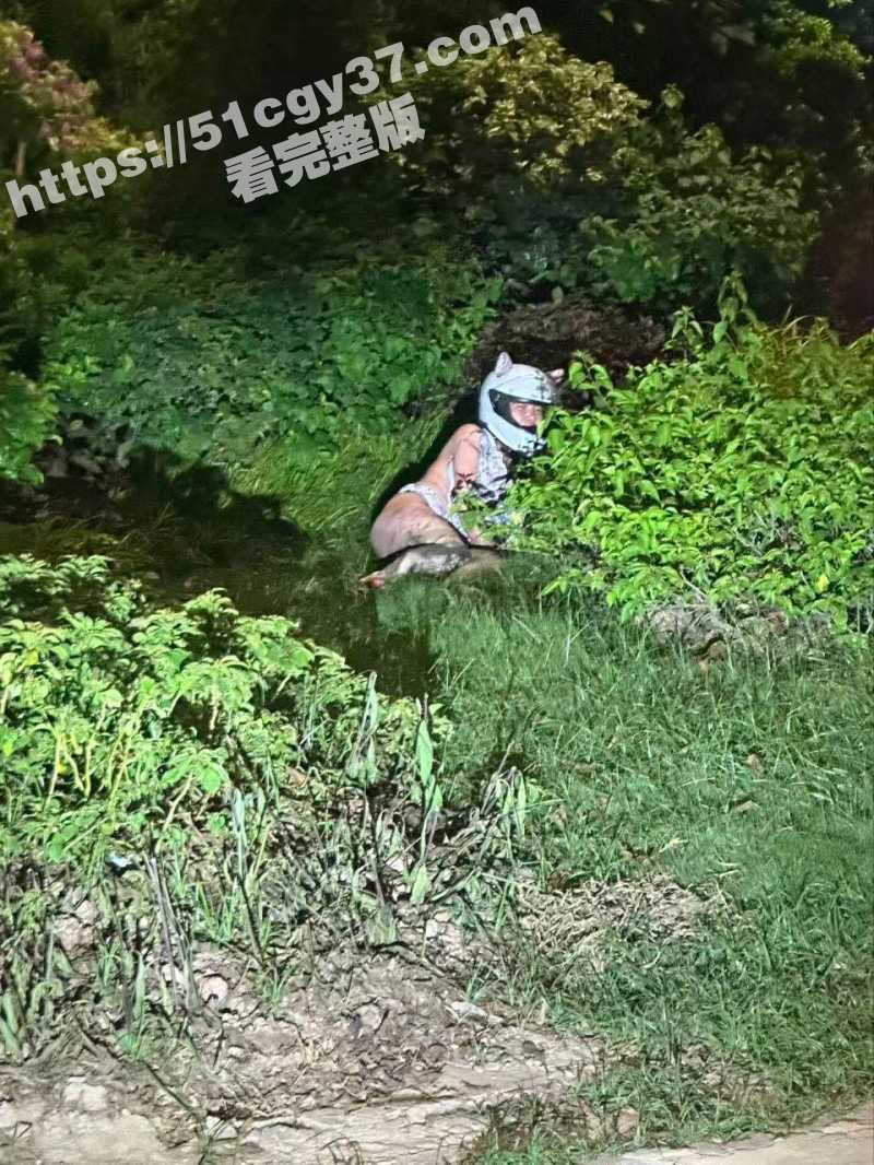 女子骑电动车起火被烧伤衣不蔽体02